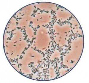 Bakteria di lechi zur